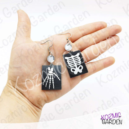 Silver Mirroed X-Ray Skeleton Hand Rib Cage Mismatched Earrings |Anatomy Jewelry